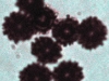 group-of-ascodesmis-spores.jpg