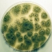 aspergillus-flavus-culture.jpg