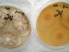 Aspergillus terreus culture