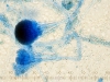gliocladium-conidiophores-spores.jpg