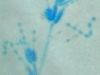 Paecilomyces marquardii spores