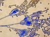 Penicillium chrysogenum spores