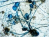 rhizopus-sporangiophores.jpg