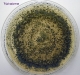 Trichoderma culture