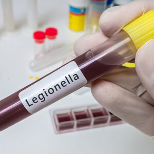 legionella course