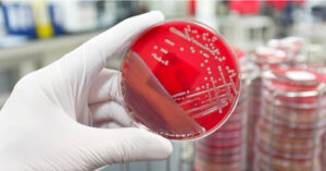 Metalworking Fluids Bacteria and Fungi | Dr Jackson Kung'u- Mold Specialist